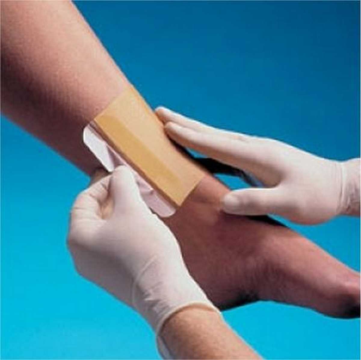 Smith & Nephew Replicare Adhesive Thin Hydrocolloid Dressing 5cm x 7cm (Pack 10)